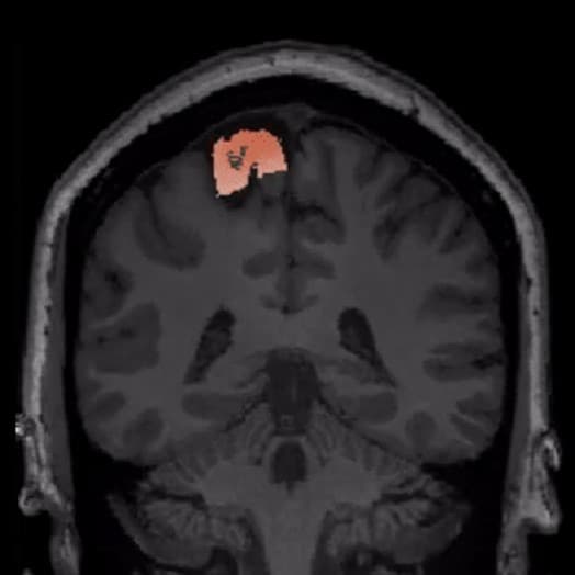 AI DIAGNOSTICS