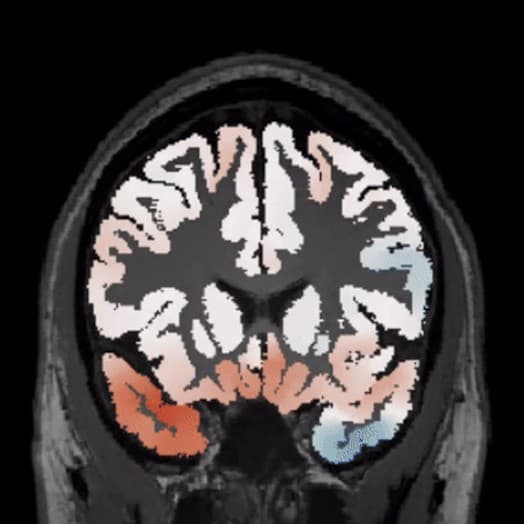 AUTOMATED DEVIATION MAPPING