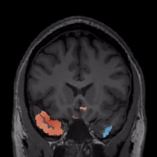 AI DIAGNOSTICS